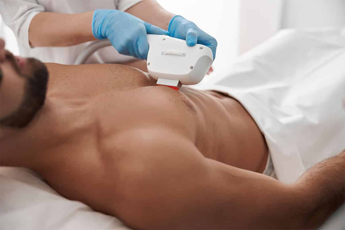 Laser Hair Removal The Hottest Trend in Manscaping
