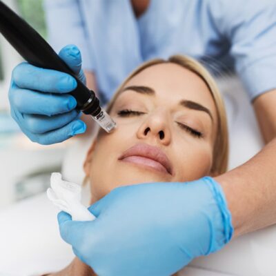 Close-up of a woman having a microneedling procedure done.