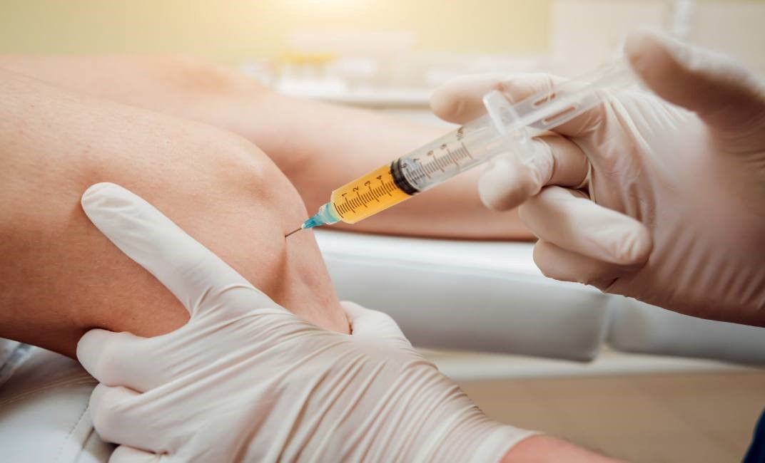 prp therapy